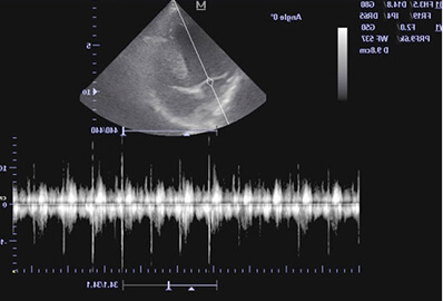 УЗИ брюшной полости собаке